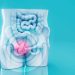 युवाओं में बढ़ रहा है Colorectal cancer, पेट दर्द और थकान को न करें नजरअंदाज