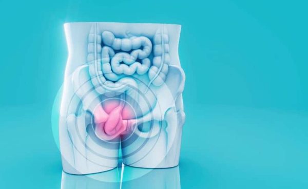 युवाओं में बढ़ रहा है Colorectal cancer, पेट दर्द और थकान को न करें नजरअंदाज