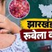 झारखंड में रूबेला का पहला मामला, 10 साल की बच्ची संक्रमित; जानें लक्षण और बचाव