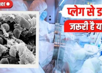 रूस में प्लेग की आशंका से बढ़ी चिंता, क्या नई महामारी का खतरा? जानें लक्षण, बचाव और इलाज